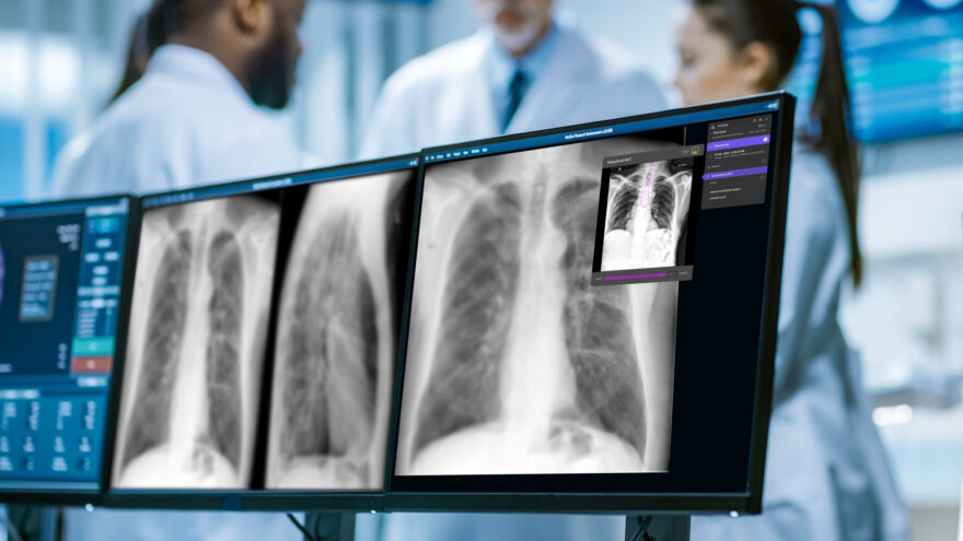 Annalise Enterprise CXR, an AI-powered tool for radiologists that can detect up to 124 chest x-ray findings.