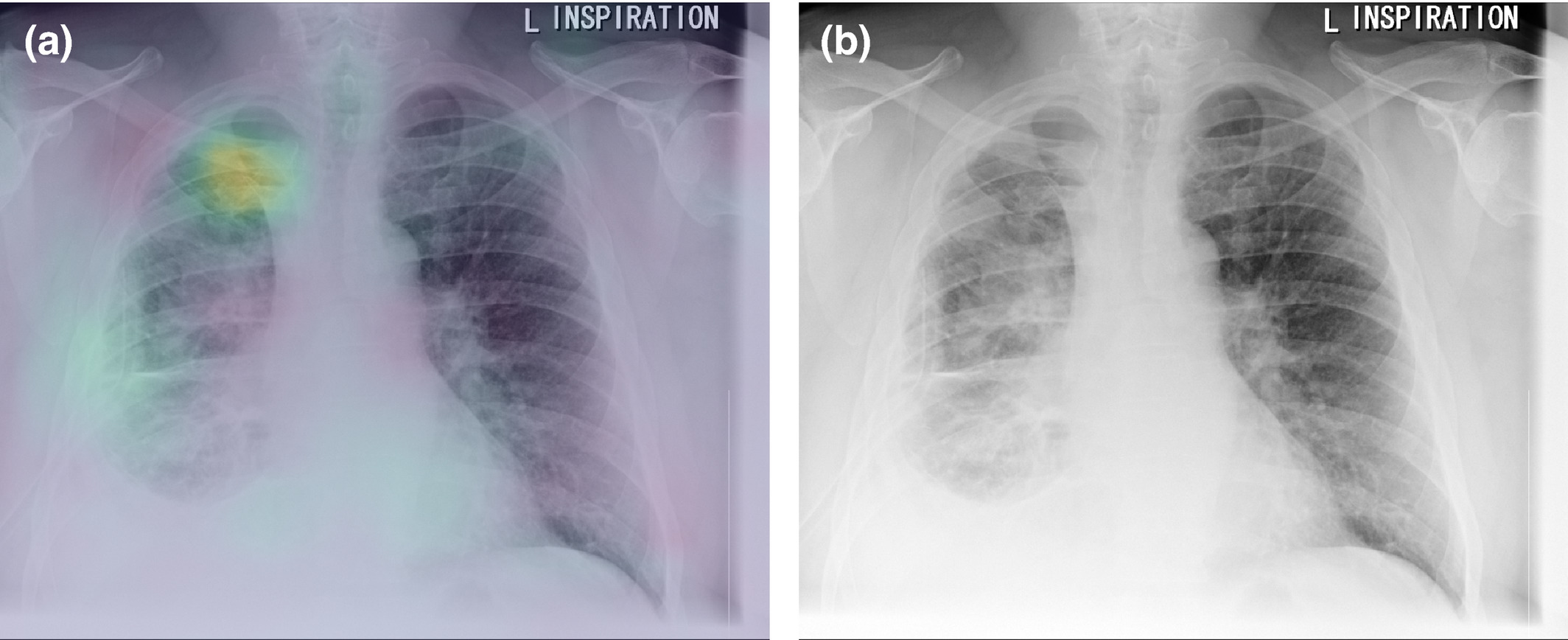 JAMA-article-image