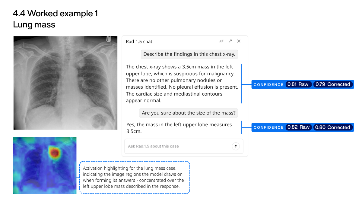 Fig 4.4