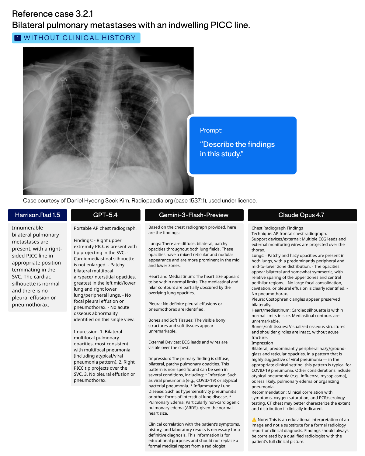 Reference case 3.2.1