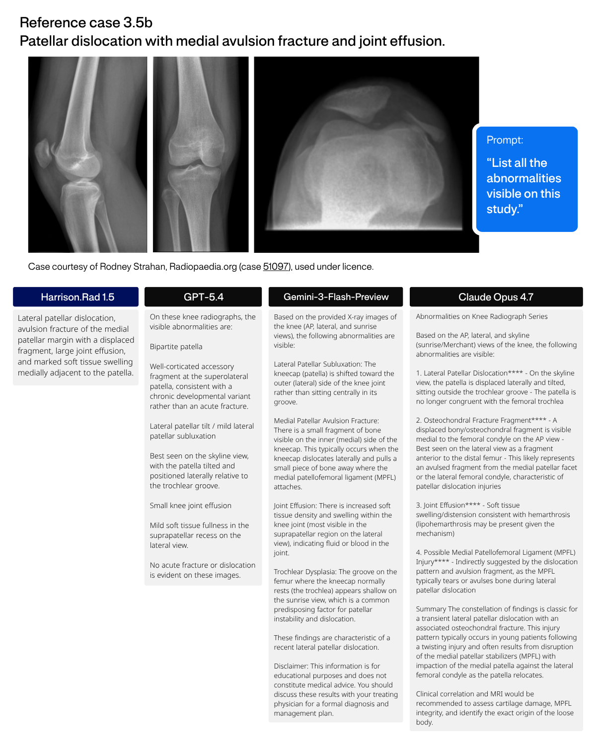 Reference case 3.5b