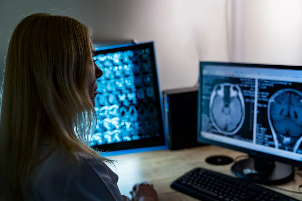 A radiologist in a dim reading room reviewing brain MRI scans on two monitors